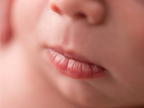 Myofunctional Therapy: Learning to Keep the Lips Sealed