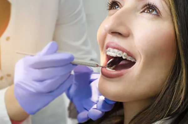 If your  orthodontist wants to  remove molars, think again