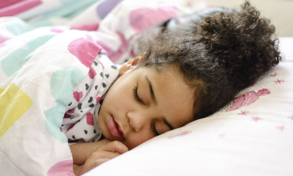 Craniofacial orthopedics and orthodontics for obstructive sleep apnea (OSA)