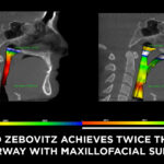 How Corrective Jaw Surgery Can Double the Size of Your Airway