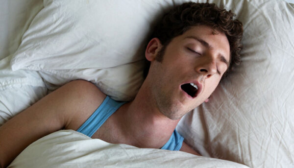 Study on oral flow and its findings related to mild versus severe sleep disordered breathing