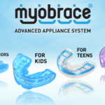 The Benefits of Myobrace Pre-Orthodontic Treatment