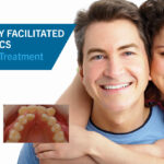 Goal Oriented Treatment with Corticotomy Facilitated Orthodontics