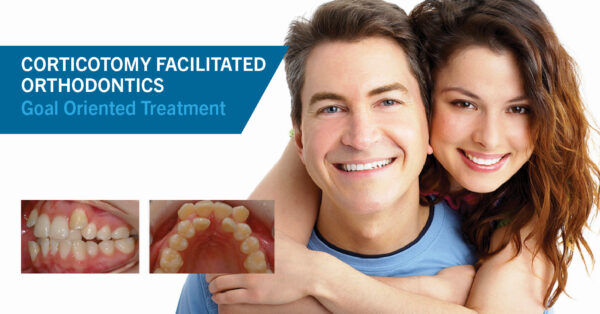 Goal Oriented Treatment with Corticotomy Facilitated Orthodontics