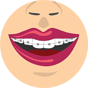 Interceptive Orthodontics
