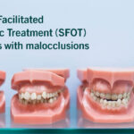 Surgically Facilitated Orthodontic Treatment (SFOT)