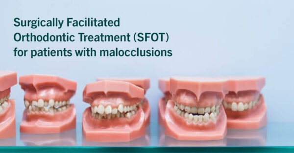 Surgically Facilitated Orthodontic Treatment (SFOT)