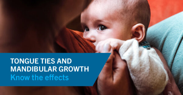 Tongue Ties and Mandibular Growth