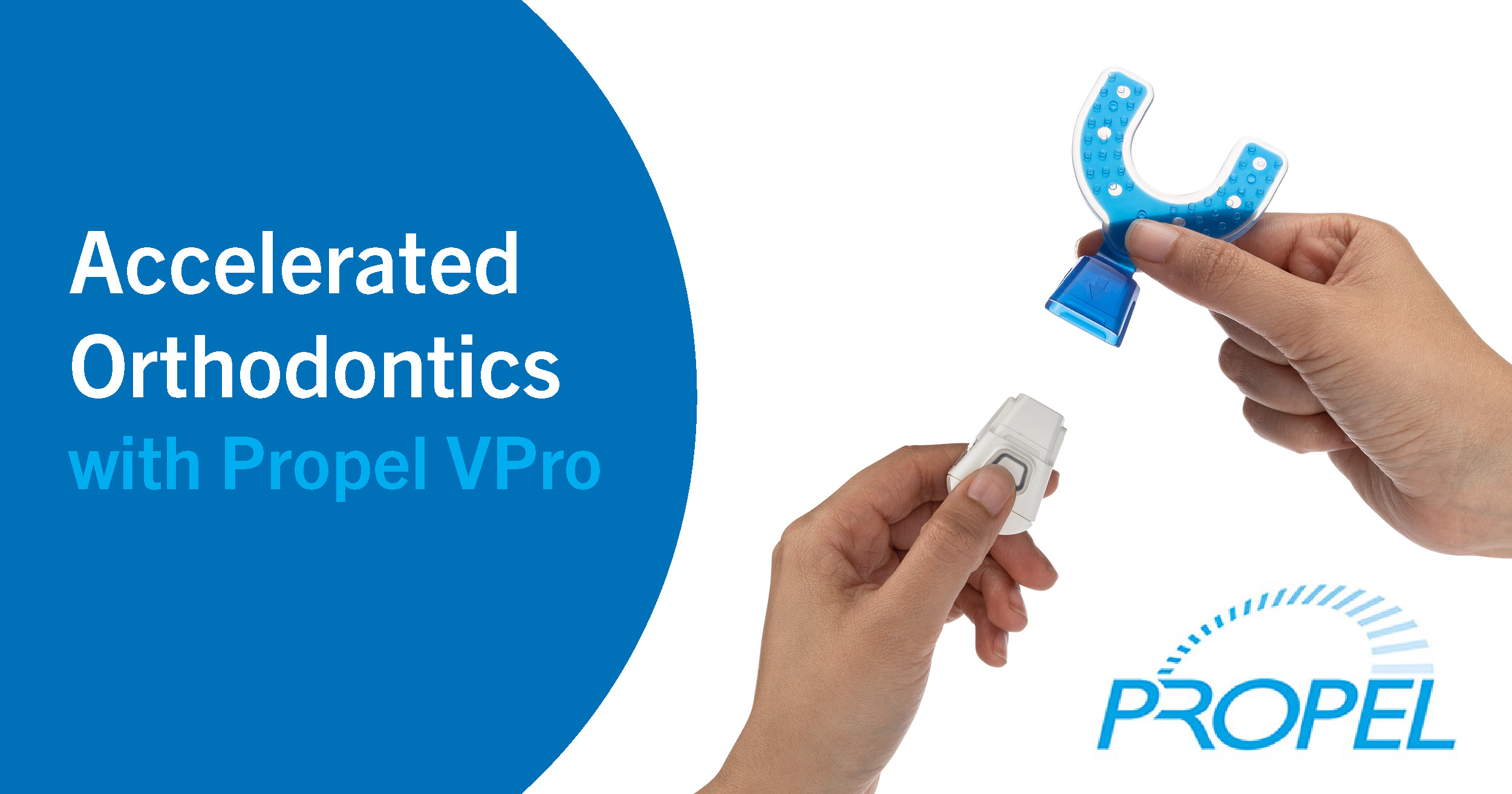 Propel VPro accelerated orthodontics