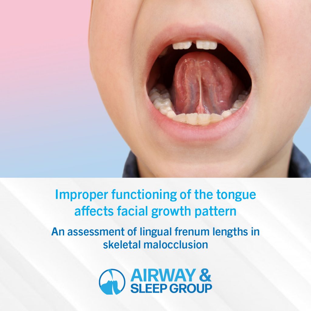 improper tongue function affects facial growth